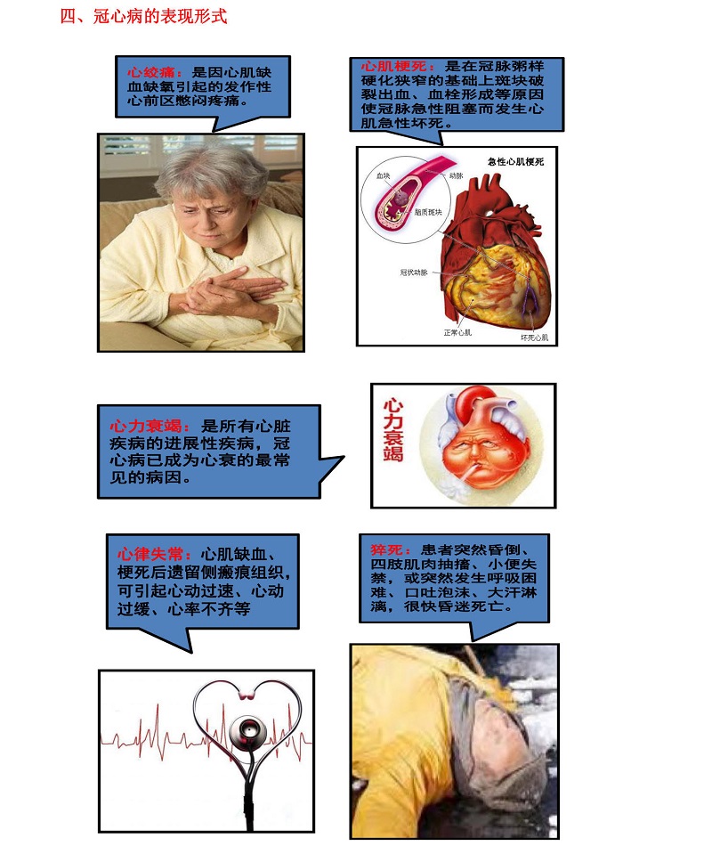 2.冠心病的预防宝典_20210609163324_2.jpg