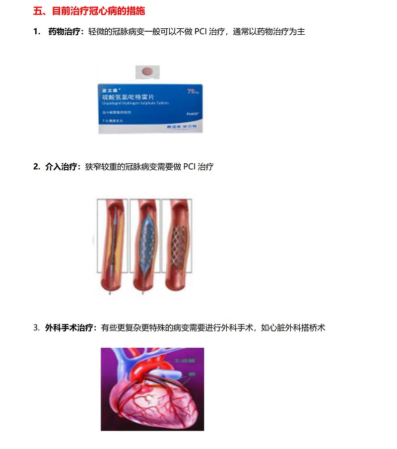 2.冠心病的预防宝典_20210609163324_3.jpg
